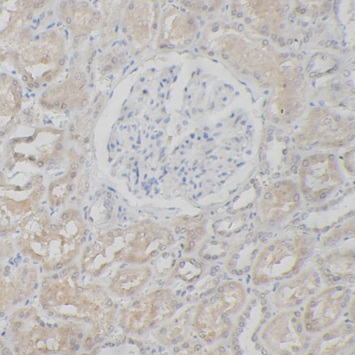 SMARCB1 antibody|SMARCB1抗体 FNa