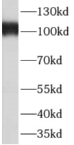 AKAP3 antibody|AKAP3抗体 FNab002