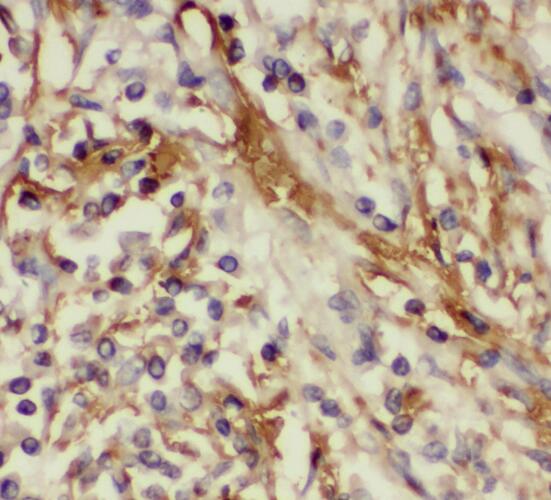 TMEM139 antibody|TMEM139抗体