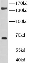 GRAMD4 antibody|GRAMD4抗体