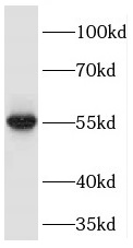 PEPD antibody|PEPD抗体