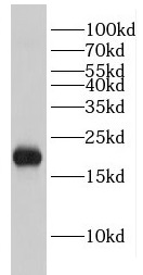 EIF1AX antibody|EIF1AX抗体 FNab0