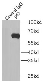 NMD3 antibody|NMD3抗体