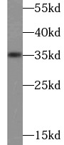 IL1A antibody|IL1A抗体