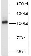 SALL2 antibody|SALL2抗体 FNab075