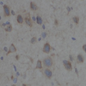 TAB2 antibody|TAB2抗体 FNab10157