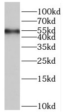 PPP4R3B antibody|PPP4R3B抗体