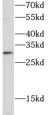 TREM1 antibody|TREM1抗体 FNab099
