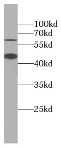 TNFRSF1A antibody|TNFRSF1A抗体 F