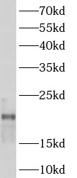 ARPC3 antibody|ARPC3抗体