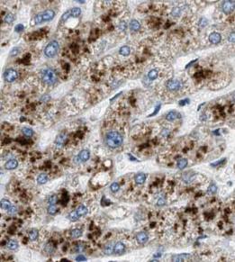 AHSG antibody|AHSG抗体 FNab03080