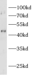 ASTL antibody|ASTL抗体