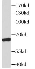 RAP1GDS1 antibody|RAP1GDS1抗体