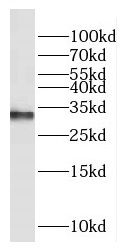 COX11 antibody|COX11抗体