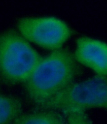 PLAU antibody|PLAU抗体