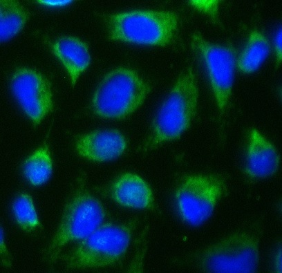 KRT14 antibody|KRT14抗体 FNab021