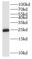 RNF125 antibody|RNF125抗体
