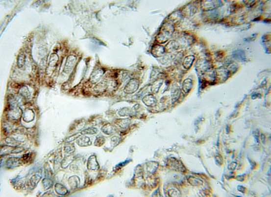 VDAC1 antibody|VDAC1抗体 FNab093