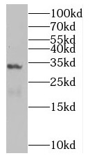 SULT1C2 antibody|SULT1C2抗体