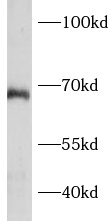 BCAS1 antibody|BCAS1抗体