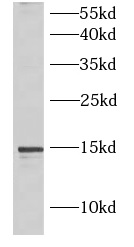 IL5 antibody|IL5抗体