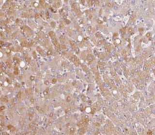 ALB antibody|ALB抗体 FNab00279