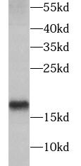 AGR2 antibody|AGR2抗体 FNab00219