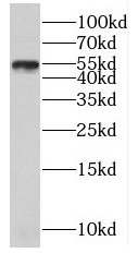PLXDC2 antibody|PLXDC2抗体