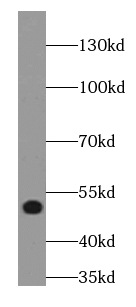 LPAR3 antibody|LPAR3抗体