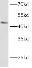 BARHL2 antibody|BARHL2抗体