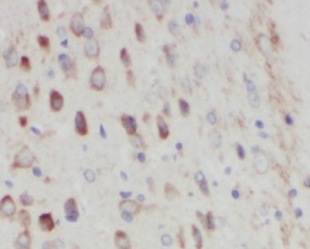 SLC6A3 antibody|SLC6A3抗体