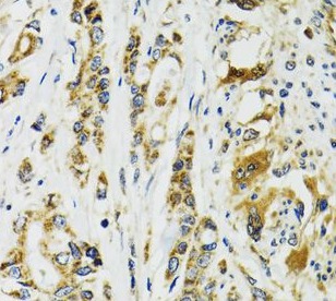 TNNC1 antibody|TNNC1抗体