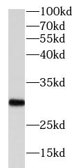 PGAM1 antibody|PGAM1抗体 FNab098