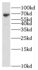 RBM47 antibody|RBM47抗体