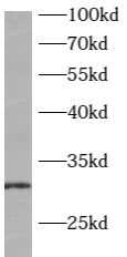 ATP6V1E2 antibody|ATP6V1E2抗体