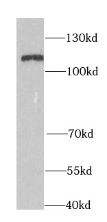 RIGI antibody|RIGI抗体 FNab02317