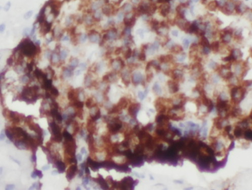 PARD6B antibody|PARD6B抗体