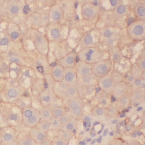 STEAP3 antibody|STEAP3抗体