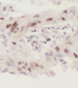 CNOT4 antibody|CNOT4抗体