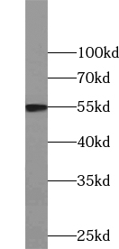 WARS2 antibody|WARS2抗体