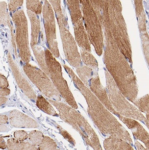CHRNA1 antibody|CHRNA1抗体