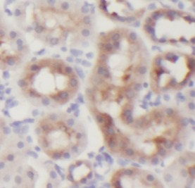 KIT antibody|KIT抗体 FNab01726