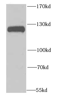 NFKB1 antibody|NFKB1抗体 FNab057