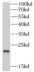 EREG antibody|EREG抗体