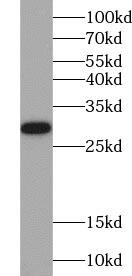 LGALS3 antibody|LGALS3抗体 FNab0