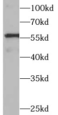 PPARG antibody|PPARG抗体 FNab066