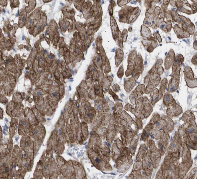 SH2D2A antibody|SH2D2A抗体