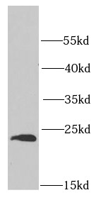 PSMB1 antibody|PSMB1抗体