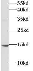 BDNF antibody|BDNF抗体 FNab10014