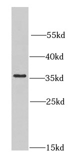CNOT8 antibody|CNOT8抗体